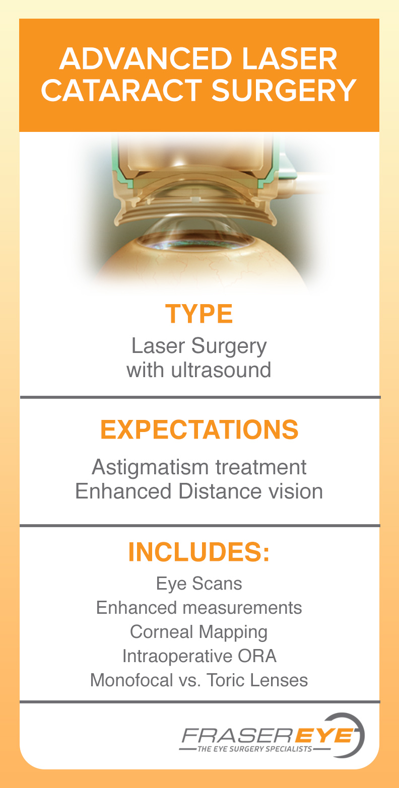 Advanced Laser Cataract surgery