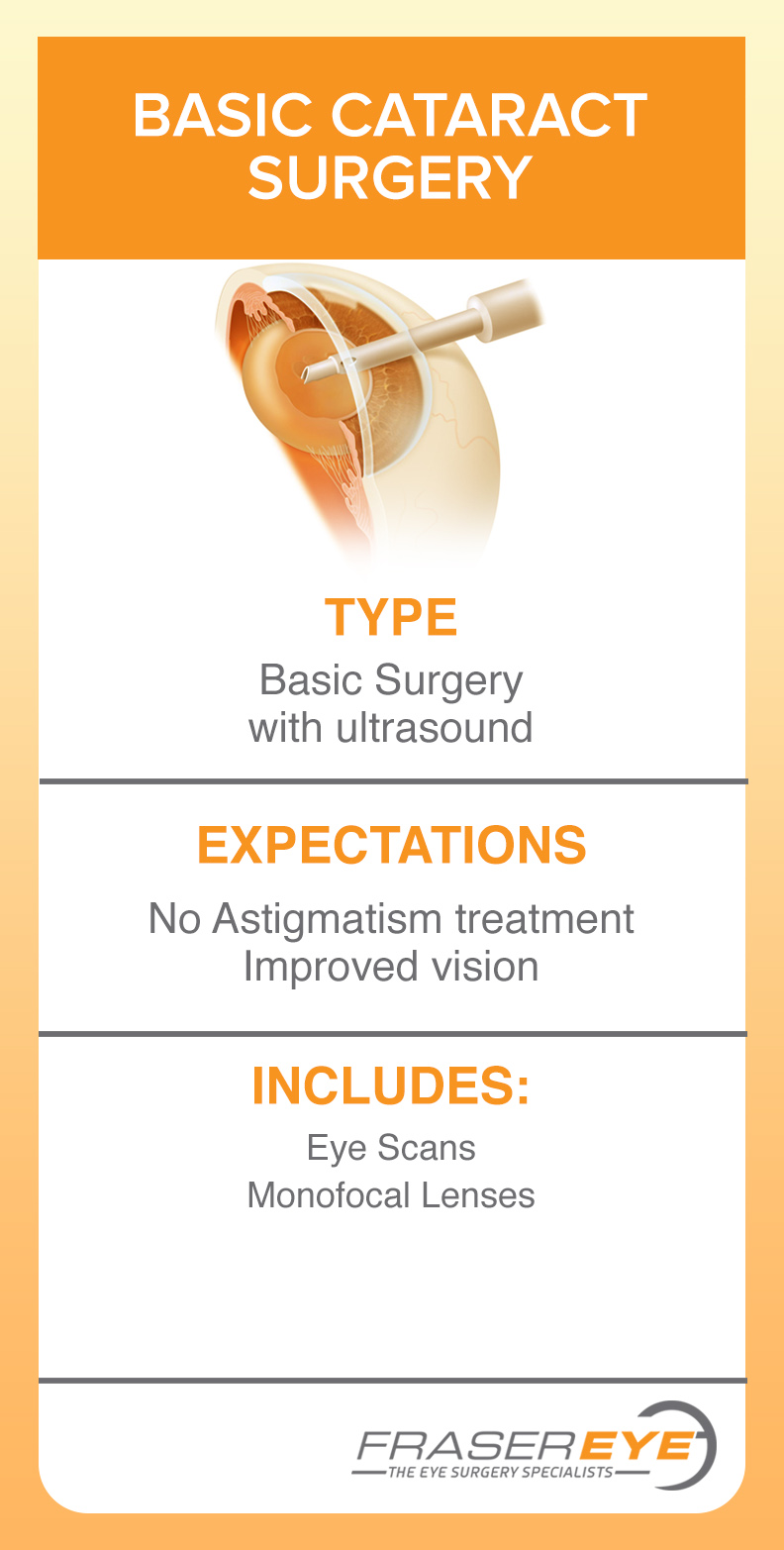 Basic Cataract surgery