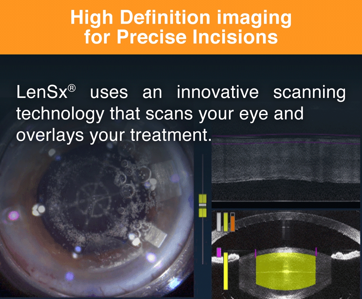 High Definition imaging for precise incisions