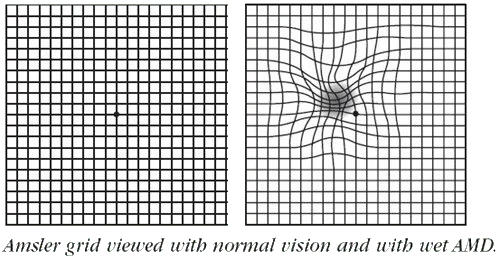 Amsler Chart to Test Your Sight  American Macular Degeneration Foundation