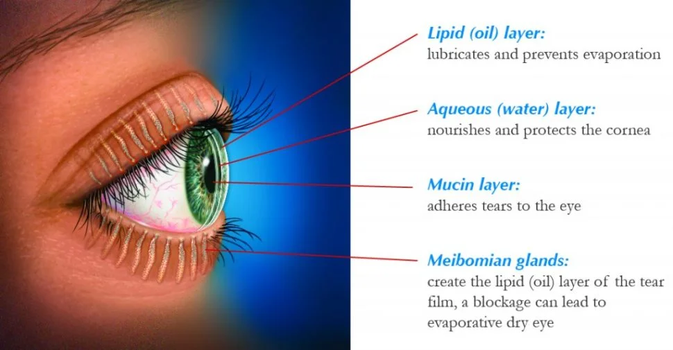 Dry eyes: Symptoms, causes and treatments